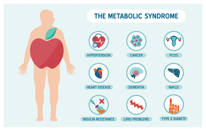 metabolikus szindróma amely nem képes lefogyni